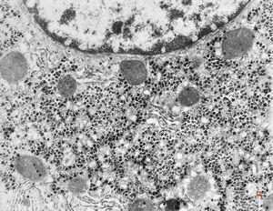 M,19y. | normal hepatocyte M,19y. | normal hepatocyte